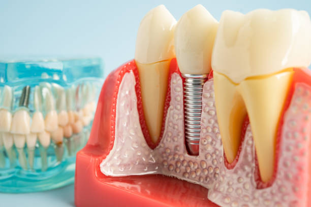 Best Periodontal (Gum) Disease Treatment  in Rupert, WV